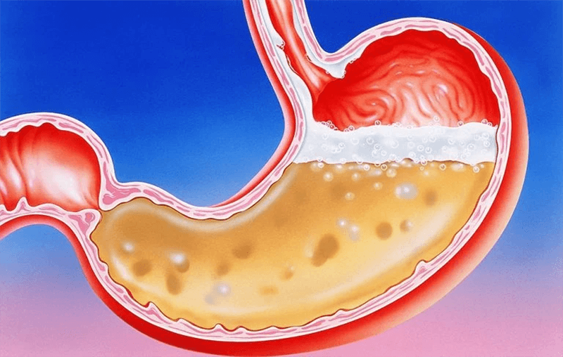 Ảnh hưởng của axit clohidric dư thừa trong dạ dày